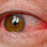 blog-image-188-1536x864