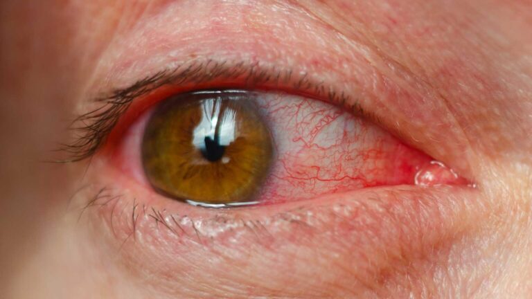 blog-image-188-1536x864